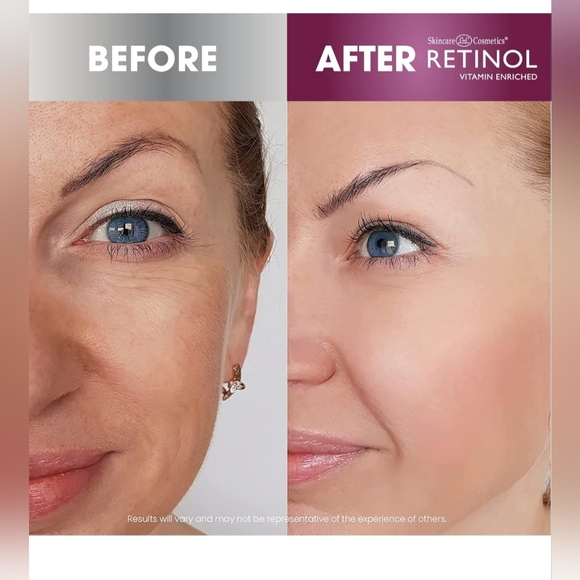 NIB Skincare Cosmetics Retinol Super Starter Kit - Picture 4 of 5